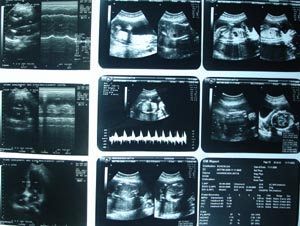 Obstetric Ultrasonography 1